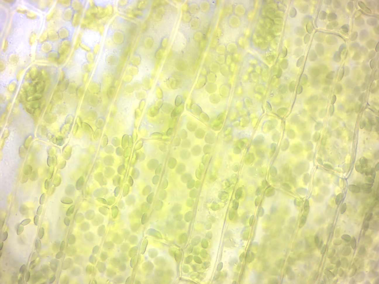 Elodea wet mount (100× oil immersion objective).