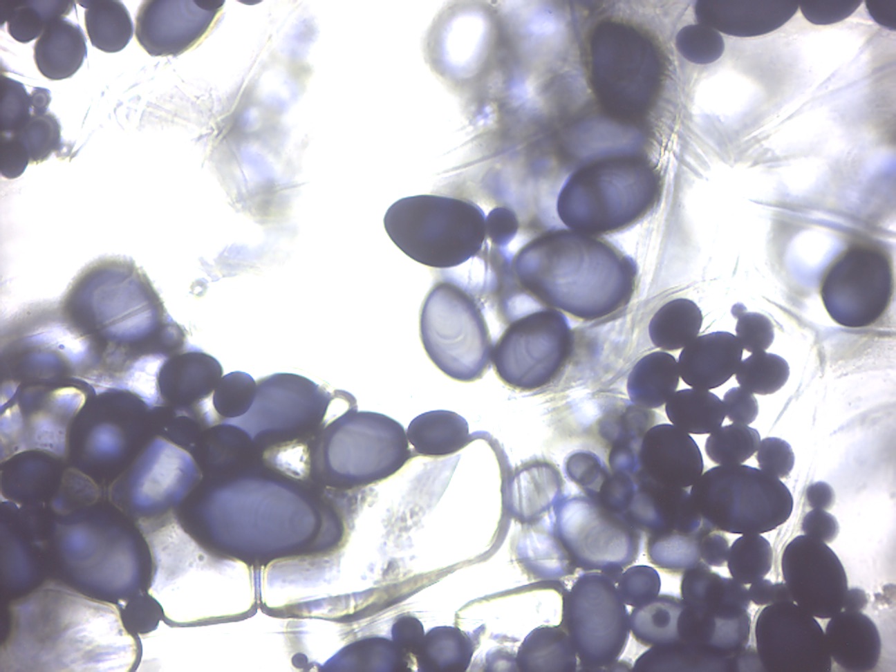 Amyloblasts in potato cells. The starch inside of the amyloplasts is stained blue-black by the iodine solution.