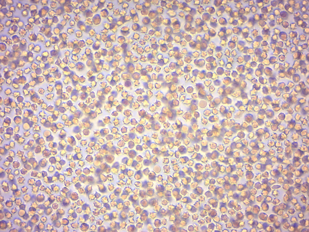 Red blood cells from sheep in hypertonic saline solution (5% NaCl).
