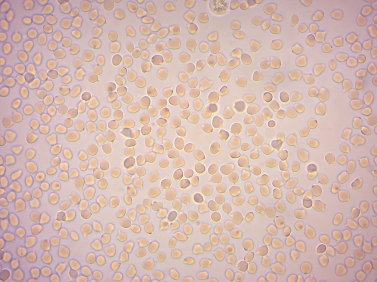 Red blood cells from sheep in distilled water.