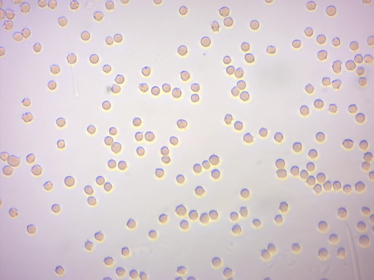 Red blood cells from sheep in isotonic saline solution (0.85% NaCl).