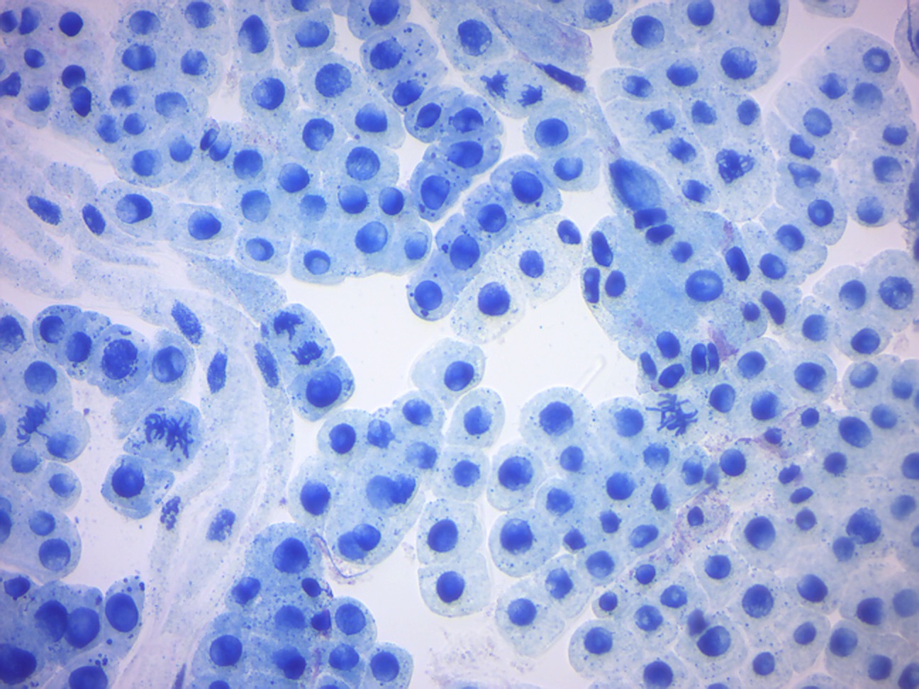 Several different phases of mitosis are visible in this onion root tip spread.