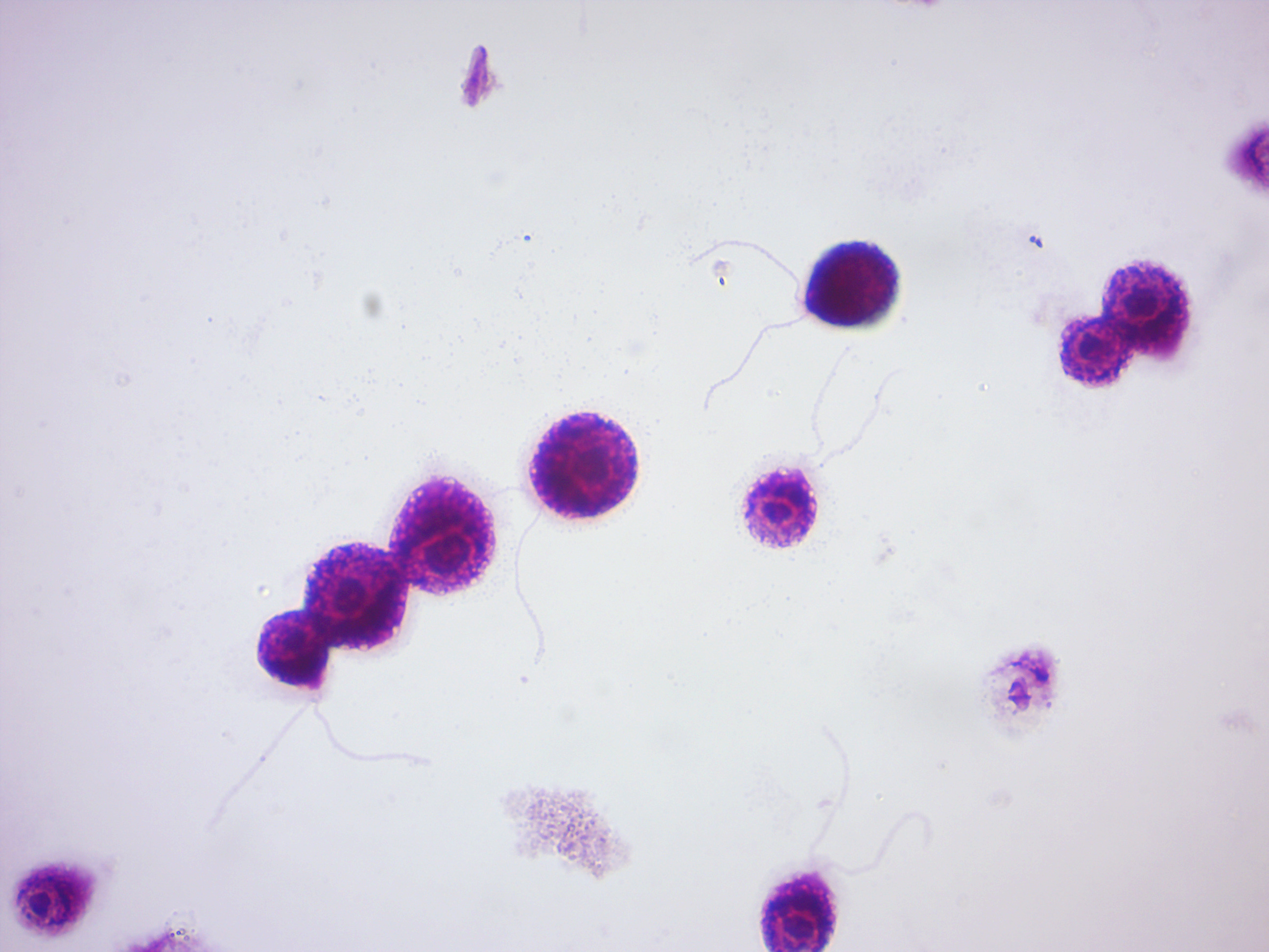 Chlamydomonas. Note the flagella.