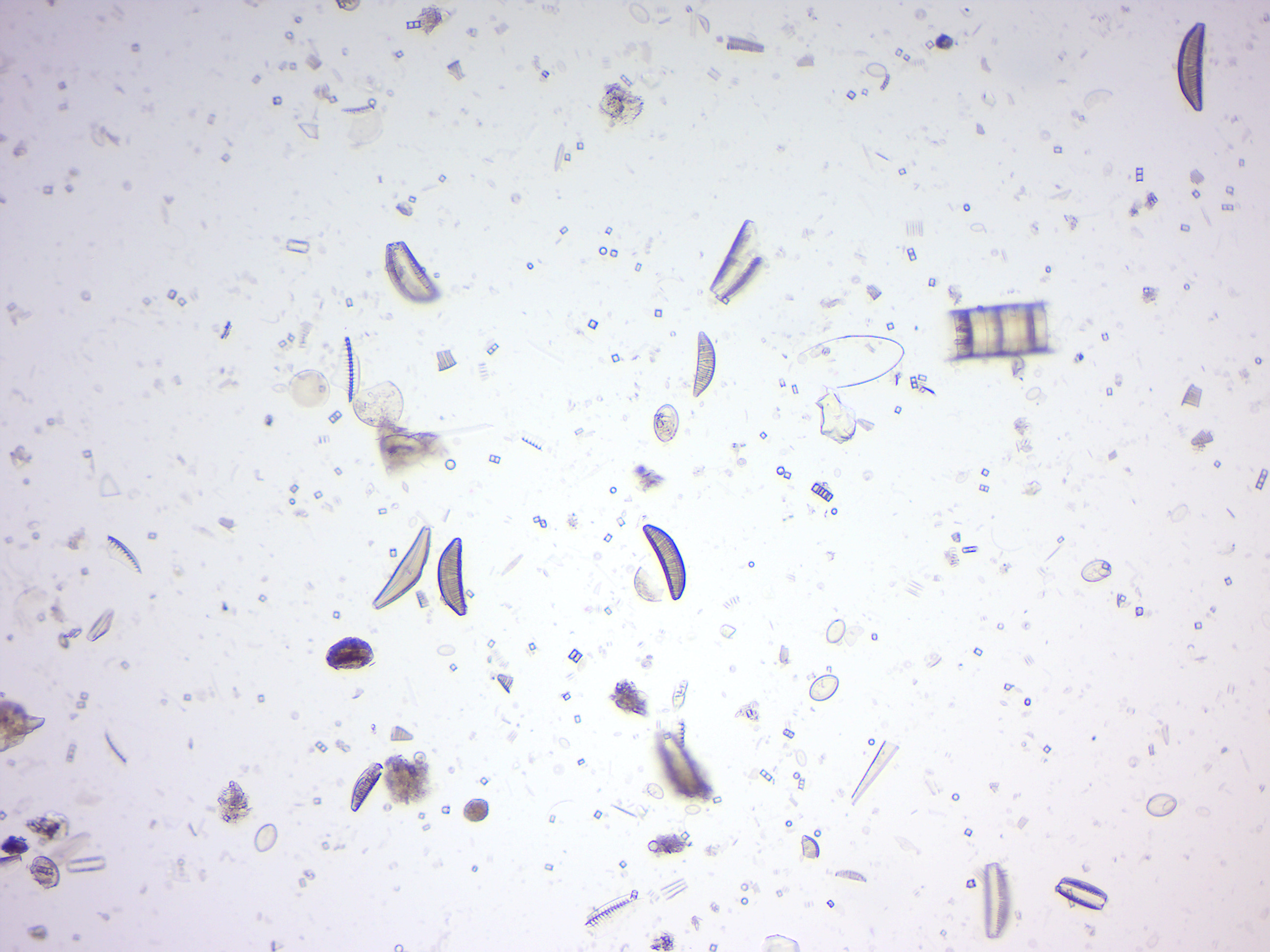 Diatomes.