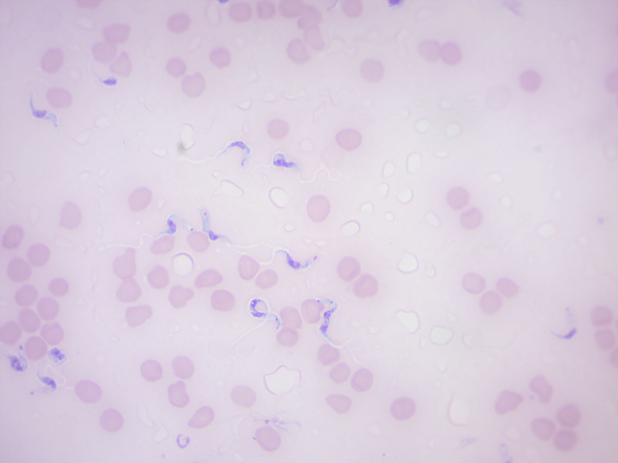 Trypanosoma brucei gambiense among red blood cells.