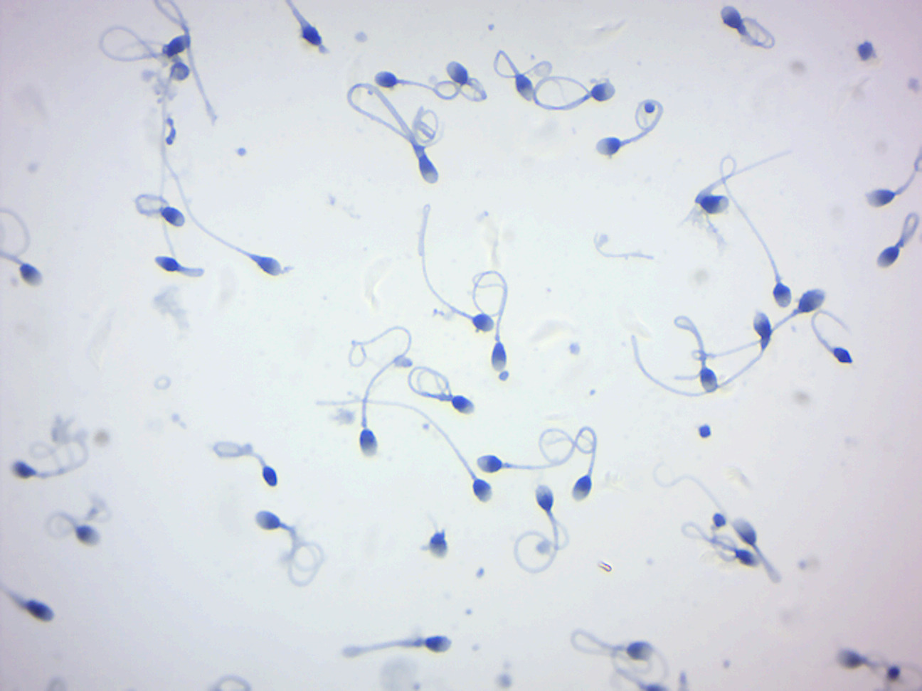 Human sperm.
