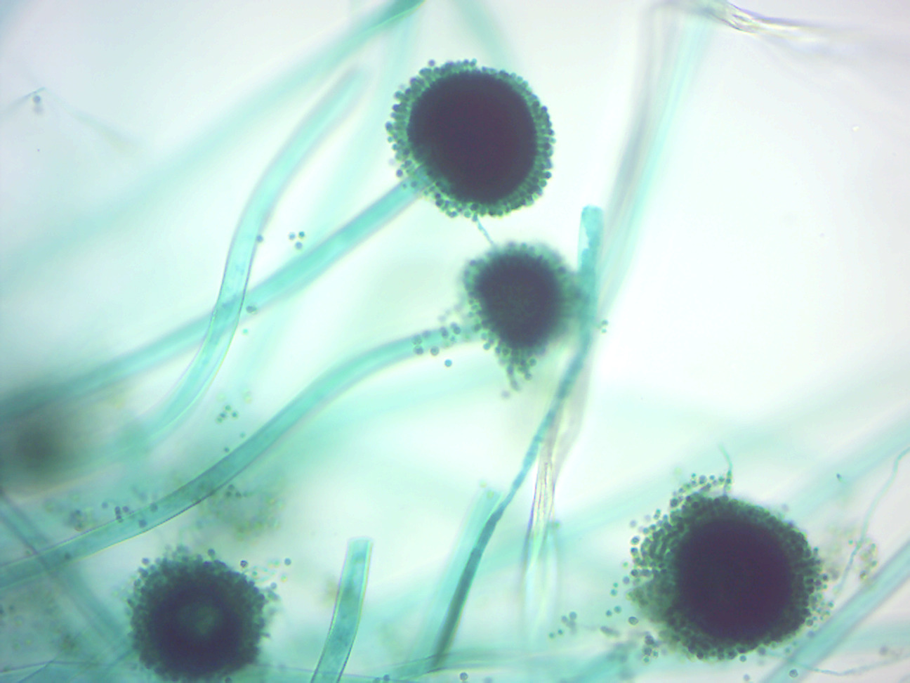 Aspergillus conidiophores.