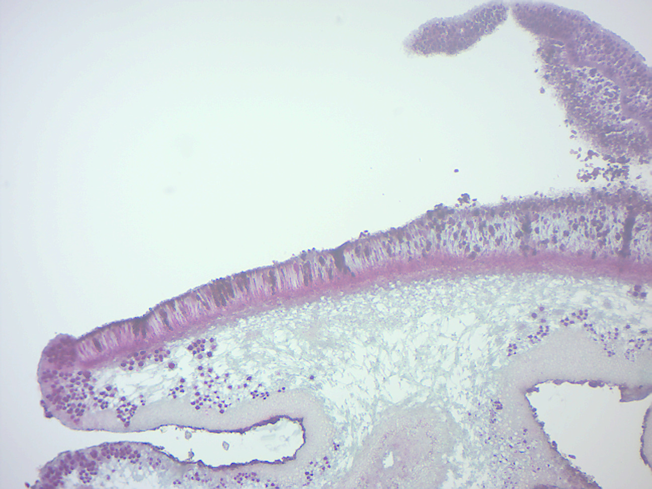 Foliose lichen thallus and apothecia.