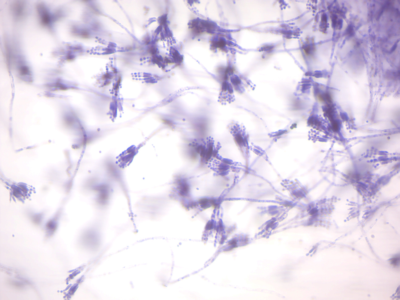 Penicillium conidiophores.