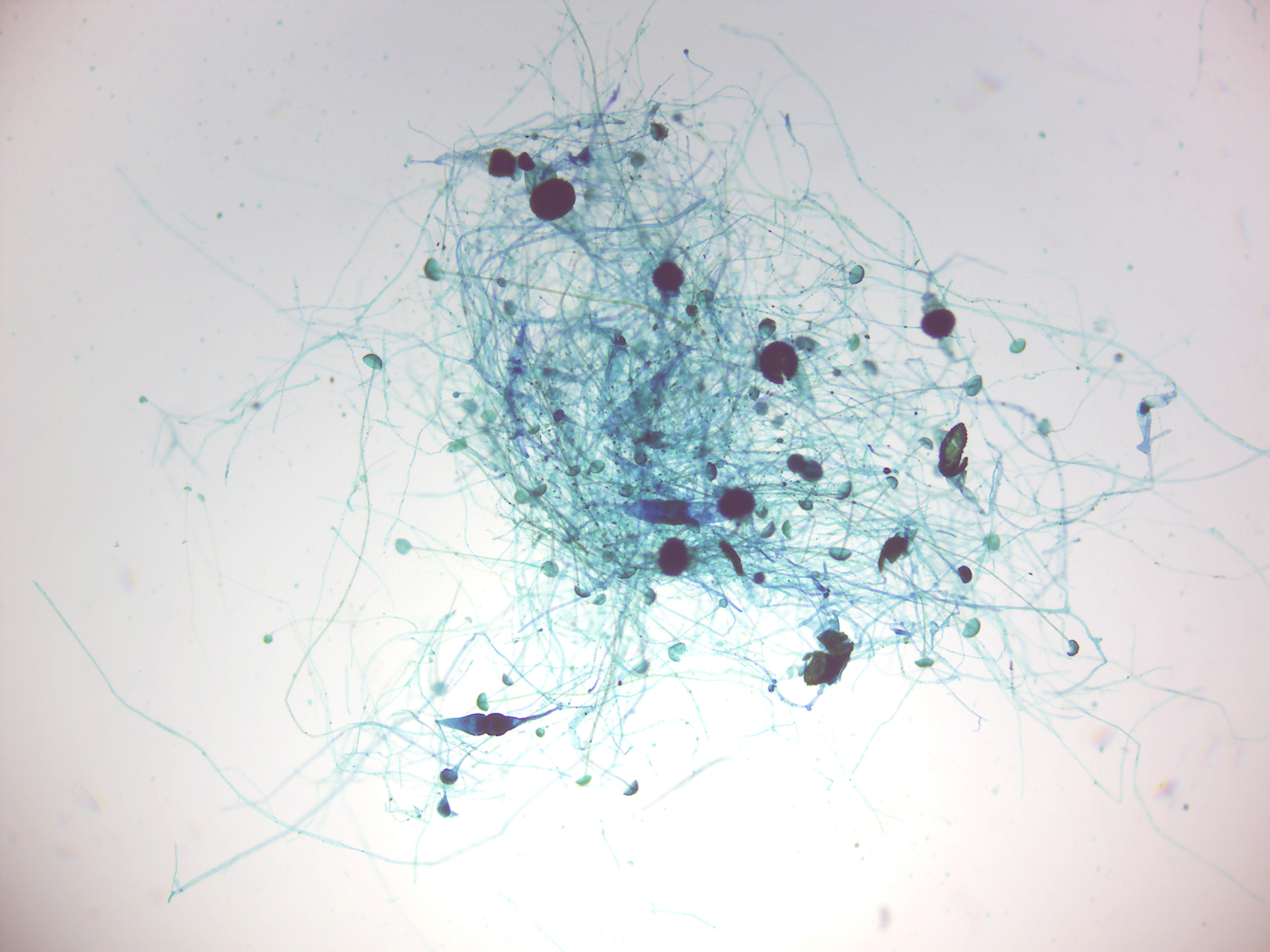 Rhizopus conjugation.