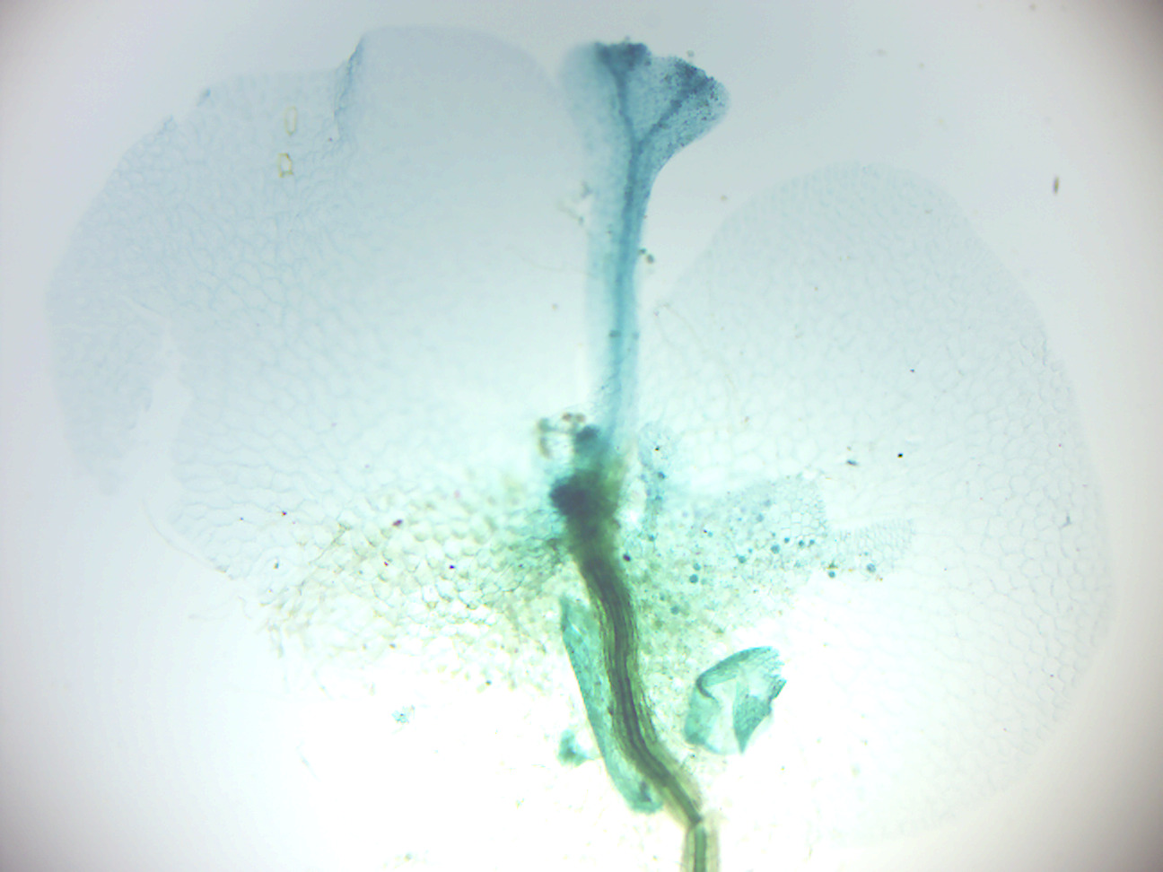 Fern prothallus young sporophyte.