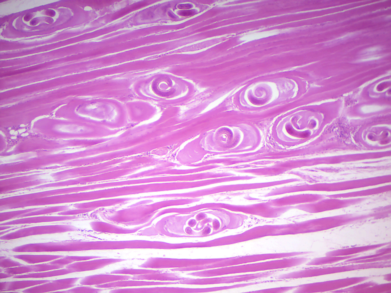 Trichinella encysted in muscle.