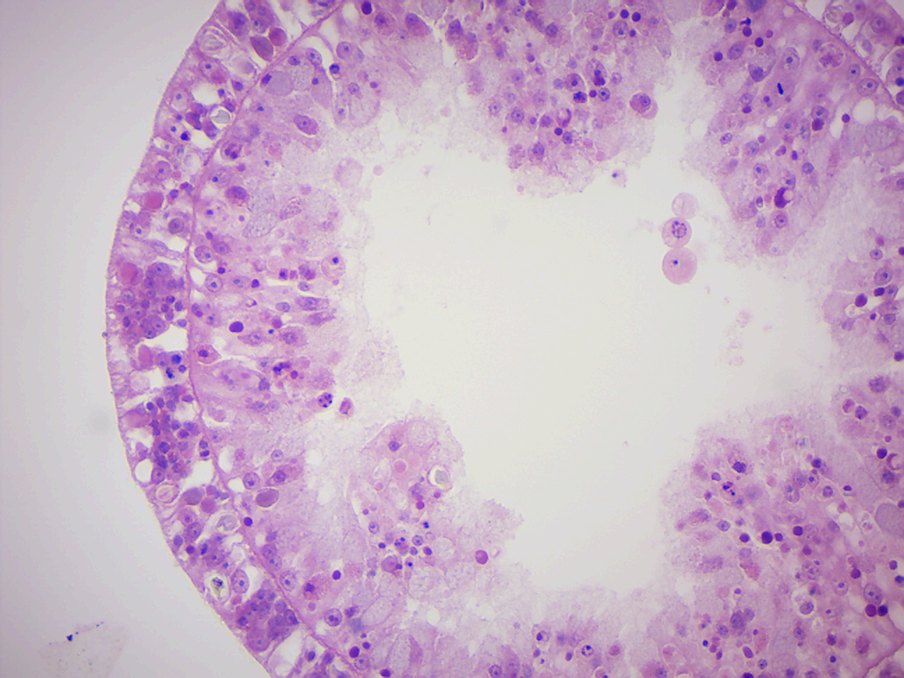 Hydra cross section.