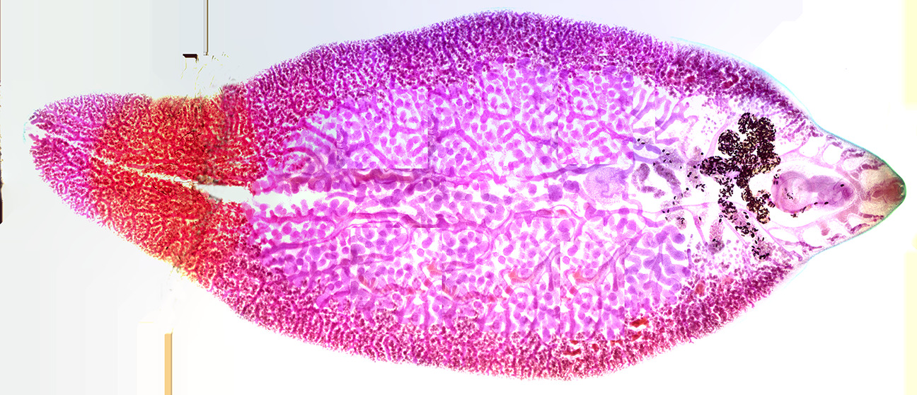 Fasciola hepatica.