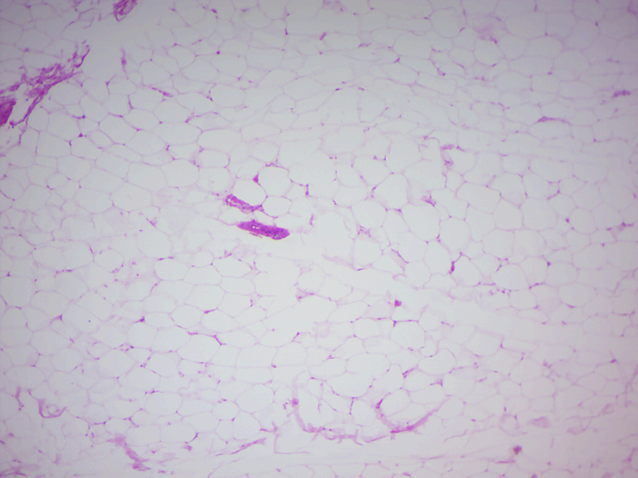 Adipose tissue.