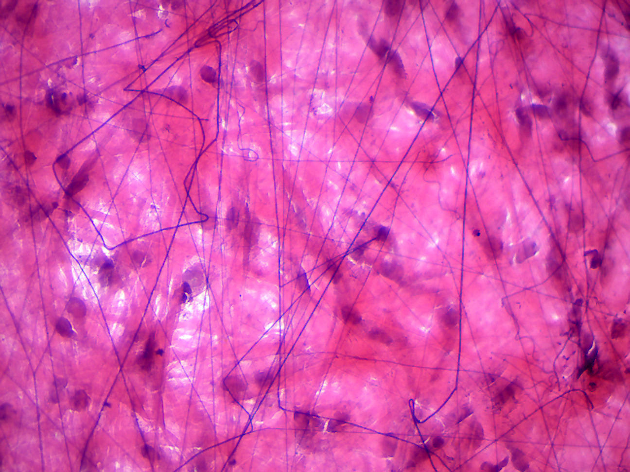 Areolar connective tissue.