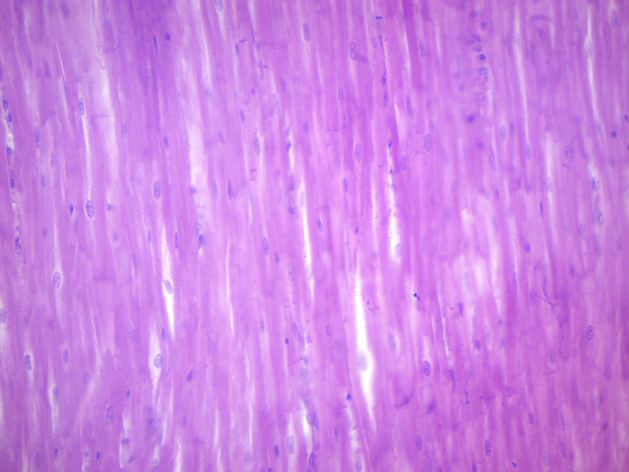 Mammalian cardiac muscle.