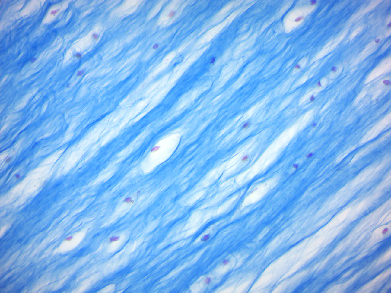 Fibrocartilage.