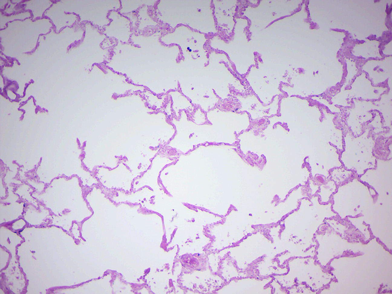 Simple squamous epithelium (human lung).