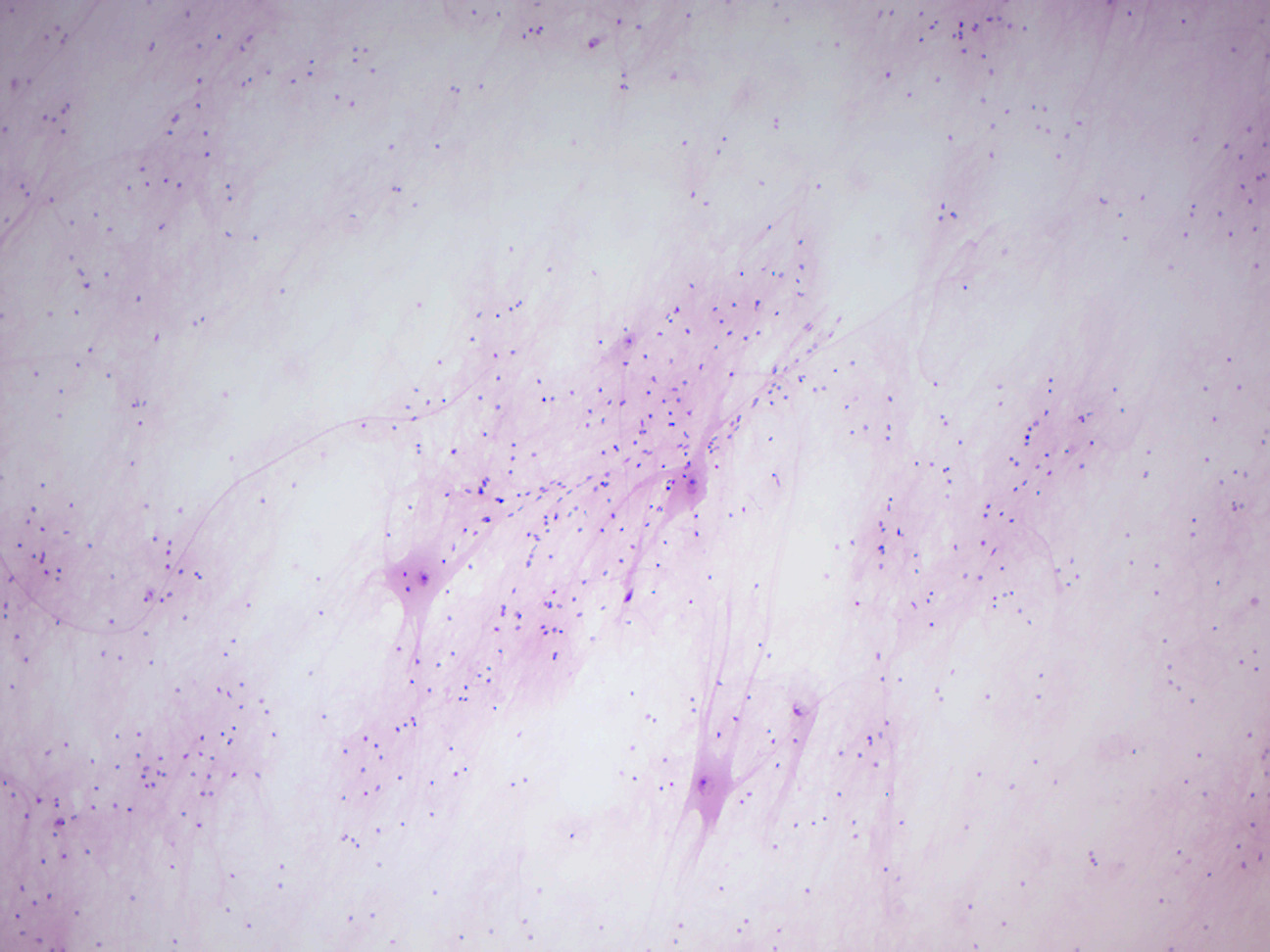 Motor neuron smear.