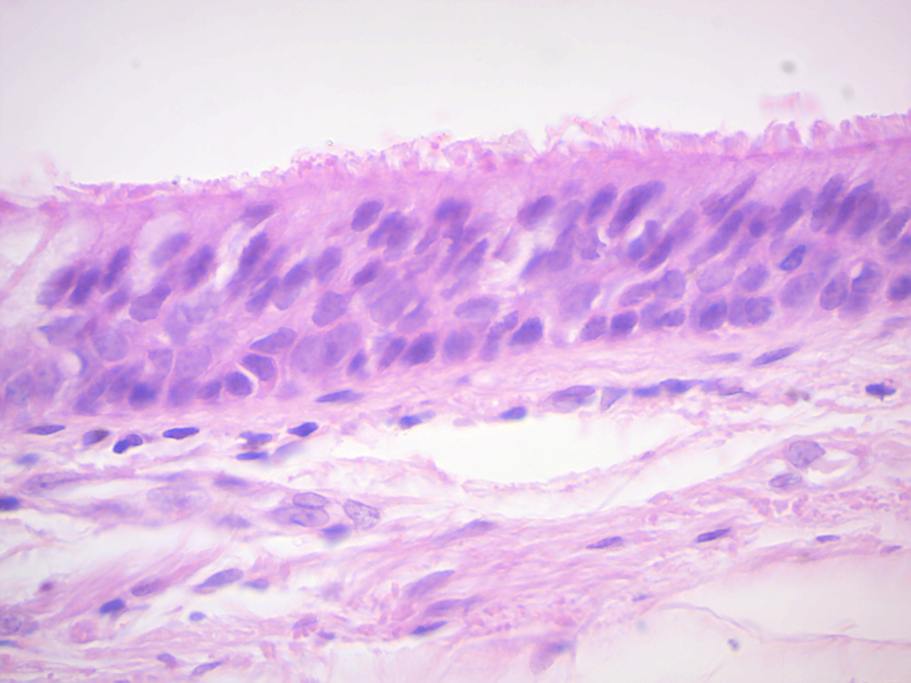 Pseudostratified ciliated columnar epithelium.
