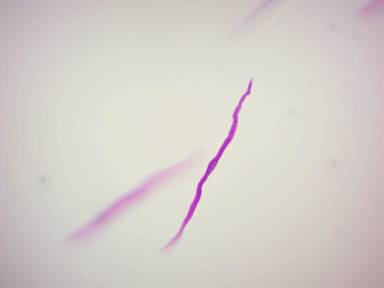 A teased smooth muscle fiber.