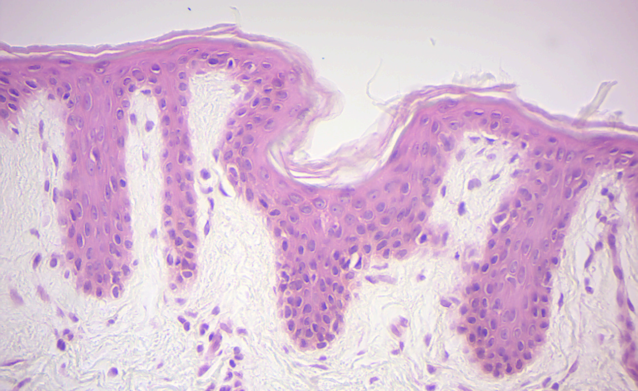 Stratified squamous epithelium (human epidermis).