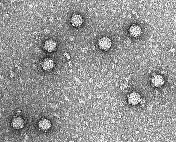 Electronmicrograp showing bacteriophage Phi X 174.