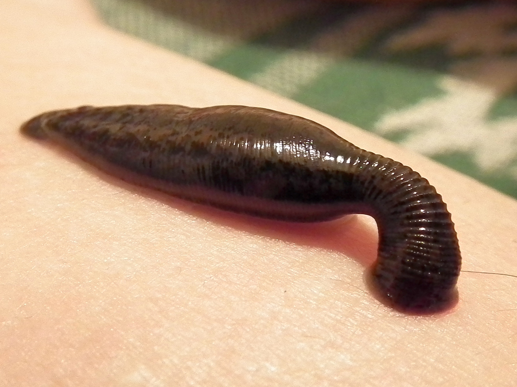 The leech Hirudo medicinalis sucking blood. Although blood-letting is used less frequently by doctors, some leech species are regarded as endangered species because they have been over-harvested for this purpose in the last few centuries.