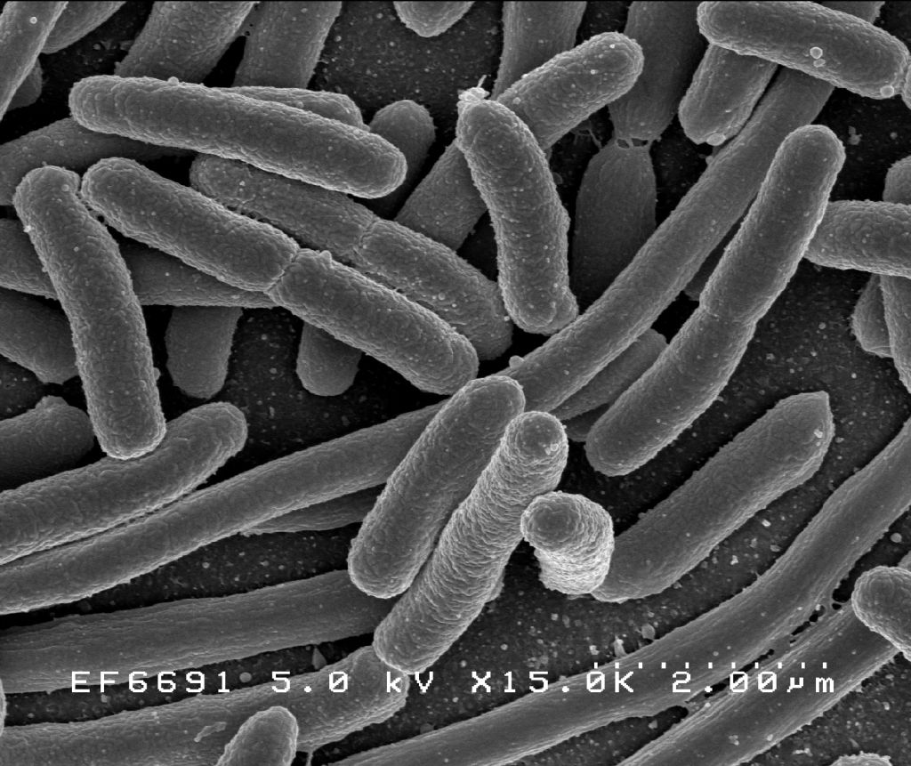 Scanning electron micrograph of Escherichia coli bacteria.