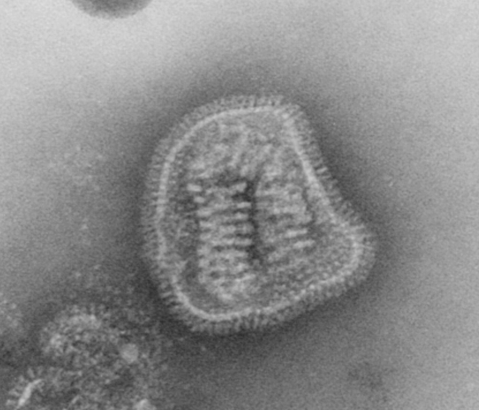 This negative-stained transmission electron micrograph (TEM) depicts the ultrastructural details of an influenza virus particle, or “virion”. A member of the taxonomic family Orthomyxoviridae, the influenza virus is an enveloped, single-stranded RNA virus. Eight helical capsis are surrounded by the viral envelope. Particle diameter: 80 -120 nm
