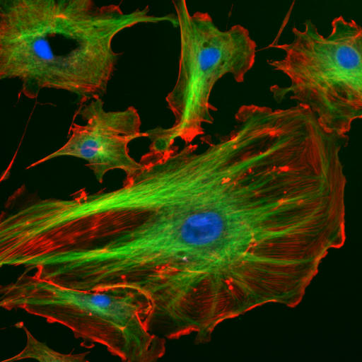 The eukaryotic cytoskeleton. Actin filaments are shown in red, and microtubules composed of beta tubulin are in green.