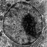 An electron micrograph of a cell nucleus, showing the darkly stained nucleolus