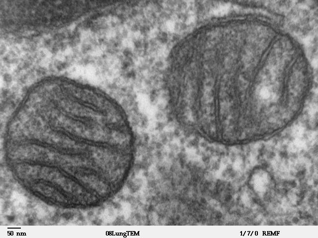 Two mitochondria from mammalian lung tissue displaying their matrix and membranes as shown by electron microscopy.