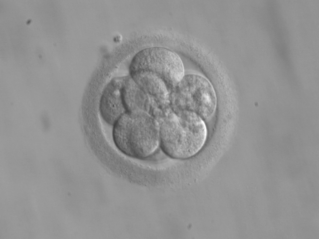 An embryo at the 8-cell stage, at 3 days.