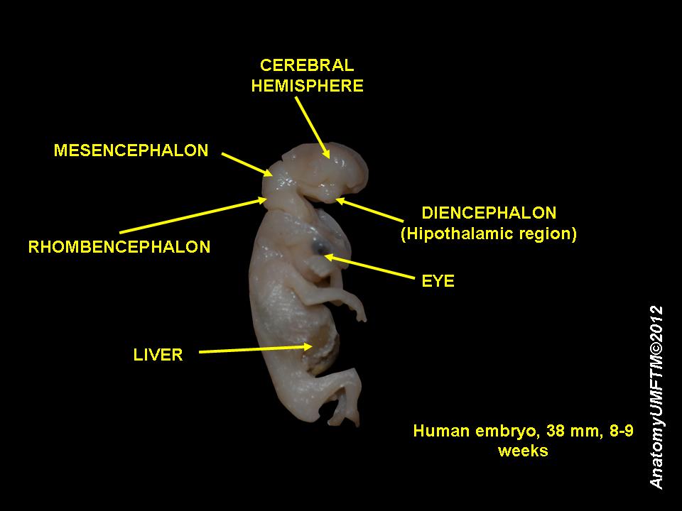 An 8 week old human embryo.
