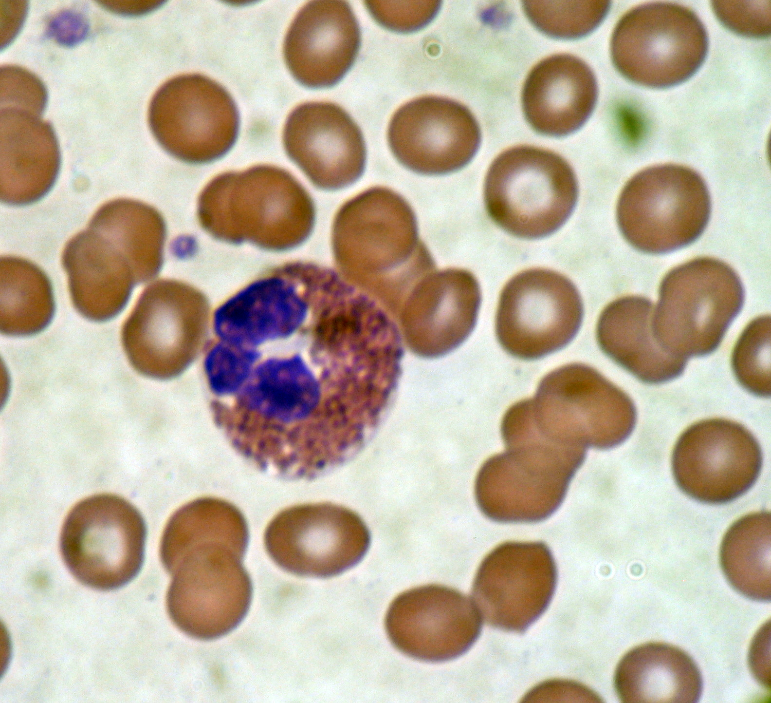 An eosinophil. Red blood cells surround the eosinophil, two platelets at the top left corner.