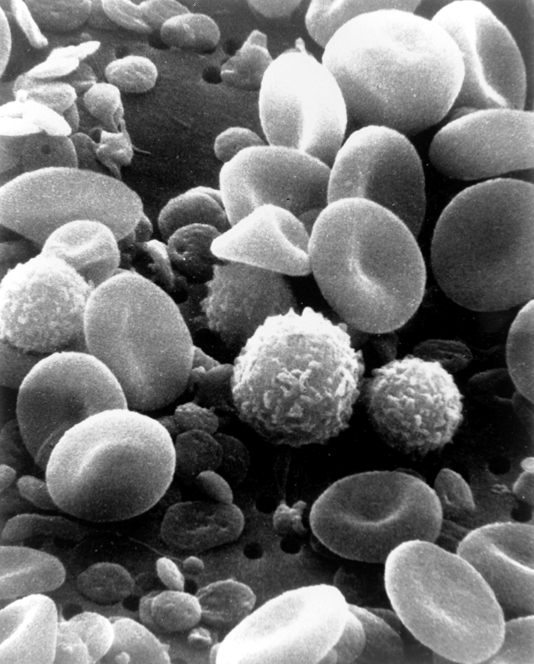 A scanning electron microscope image of normal circulating human blood. One can see red blood cells, several knobby white blood cells including lymphocytes, a monocyte, a neutrophil, and many small disc-shape platelets.