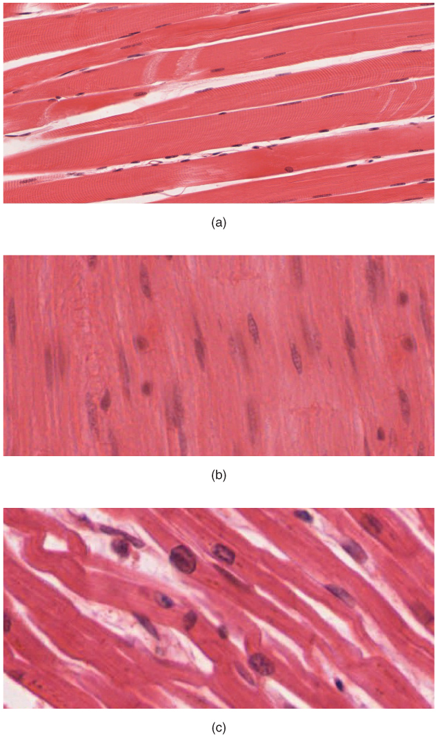The body contains three types of muscle tissue: (a) skeletal muscle, (b) smooth muscle, and (c) cardiac muscle.