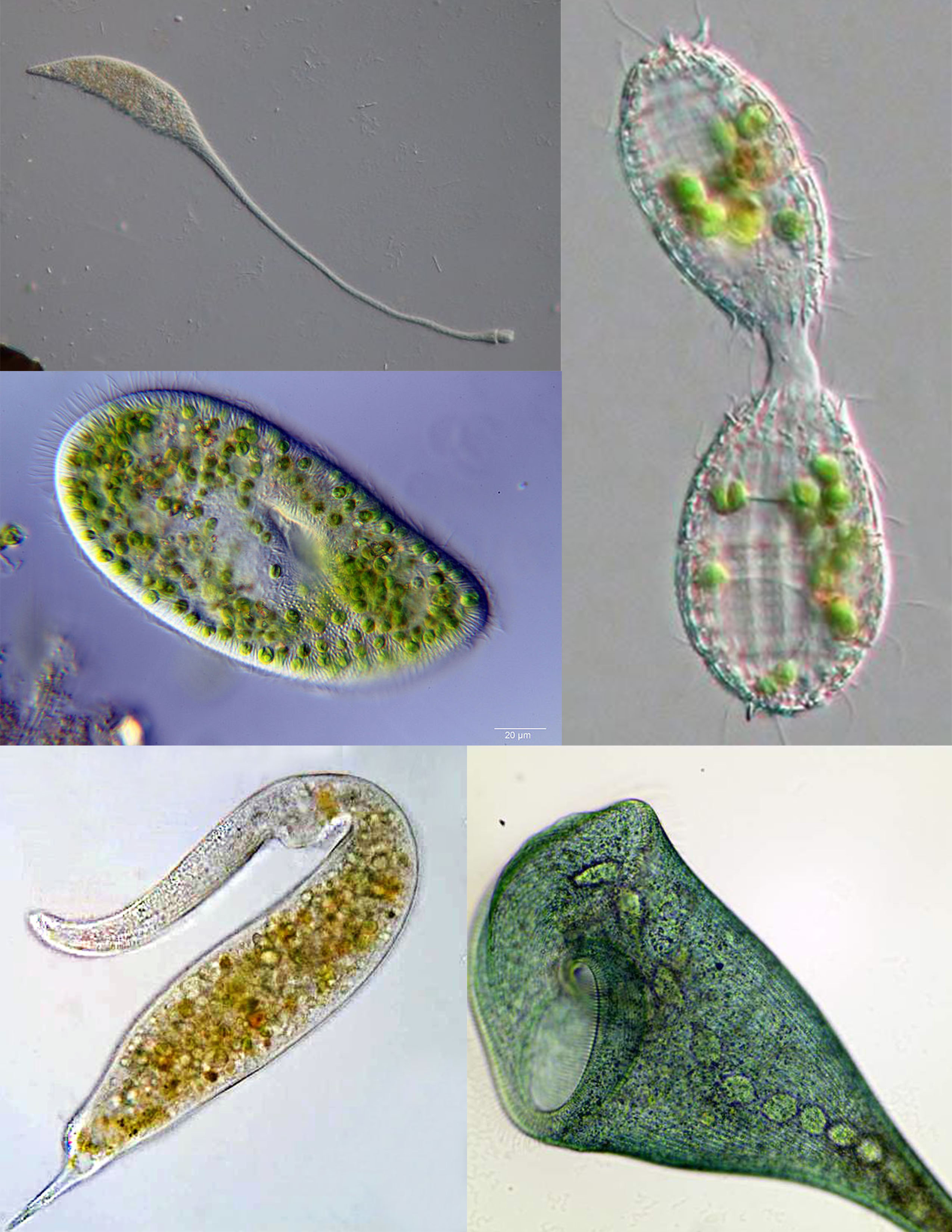 Composite image of various ciliates: Lacrymaria olor, Paramecium bursaria, Coleps, Dileptus, Stentor coeruleus.