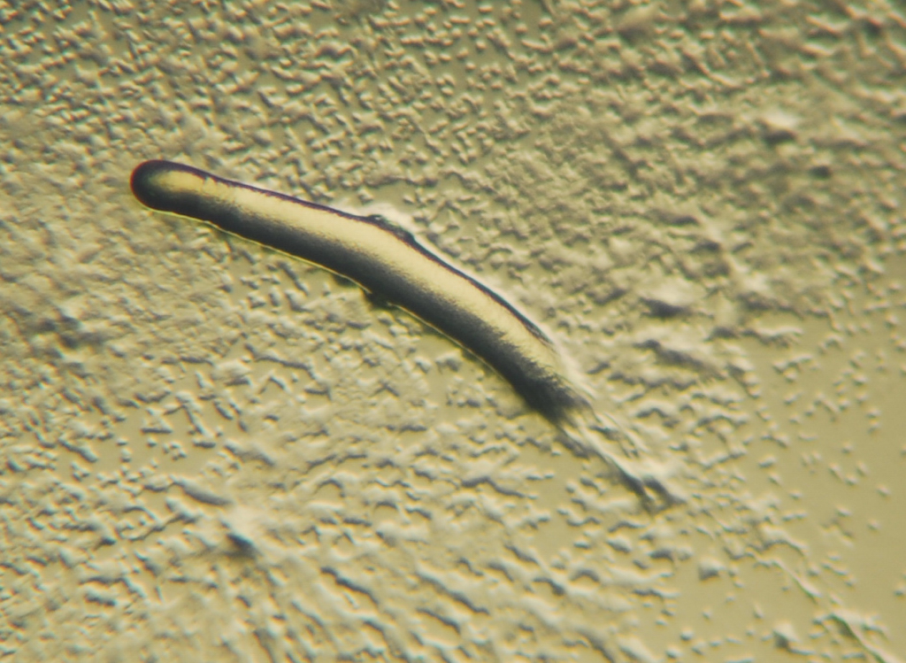 Pseudoplasmodium or “slug” of a Dictyostelium