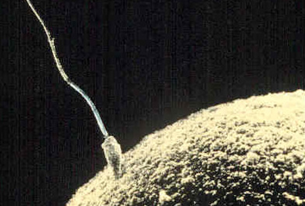 Sperm fertilizing an egg.