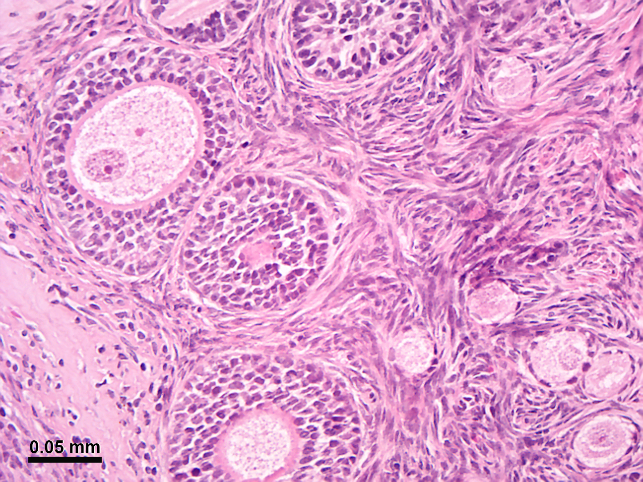Micrograph of the ovarian cortex from a rhesus monkey showing several round follicles embedded in a matrix of stromal cells. A secondary follicle sectioned through the nucleus of an oocyte is at the upper left, and earlier stage follicles are at the lower right. The tissue was stained with the dyes hematoxylin and eosin.