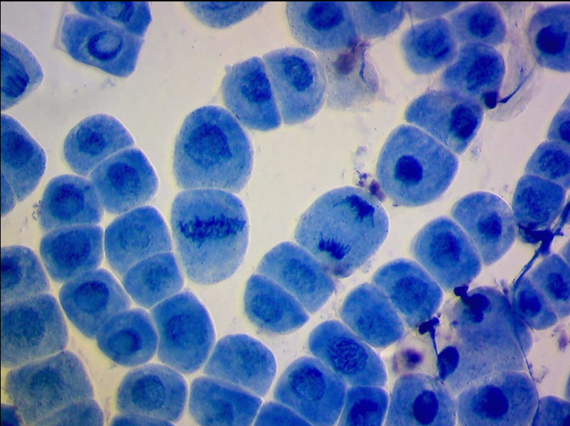 Several different phases of mitosis are visible in this onion root tip spread.