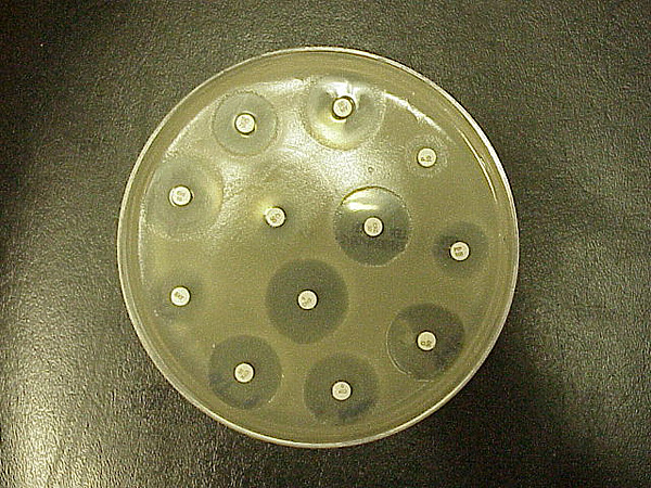 Standard Kirby–Bauer testing: White disks containing antibiotics shown on an agar plate of bacteria. Circular zones of poor bacterial growth surround some disks, indicating susceptibility to the antibiotic.