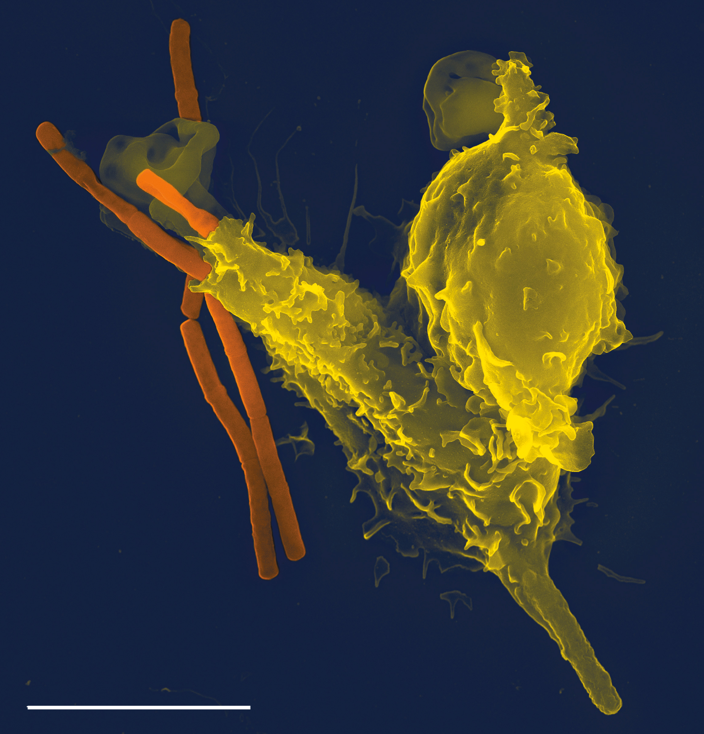 Scanning electron micrograph of a neutrophil phagocytosing anthrax bacilli (orange). Scale bar is 5 micrometers.