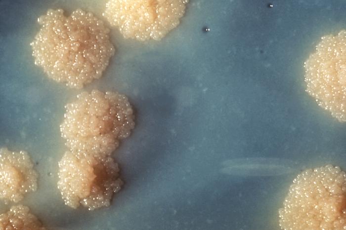 A close-up photogrpaph of a Mycobacterium tuberculosis culture revealing this organism’s colonial morphology. Note the colorless rough surface, which are typical morphologic characteristics seen in Mycobacterium tuberculosis colonial growth. Macroscopic examination of colonial growth patterns is still one of the ways microorganisms are often identified.