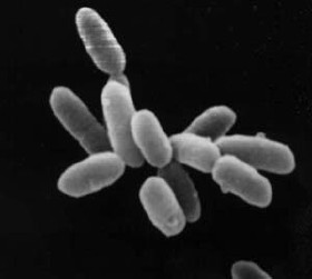 Halobacterium sp. strain NRC-1, each cell is about 5 μm long