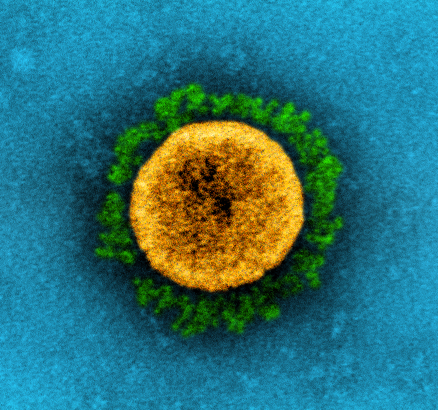 Transmission electron micrograph of a SARS-CoV-2 virus particle (UK B.1.1.7 variant), isolated from a patient sample and cultivated in cell culture. The prominent projections (green) seen on the outside of the virus particle (yellow) are spike proteins. This fringe of proteins enables the virus to attach to and infect host cells and then replicate. Image captured at the NIAID Integrated Research Facility (IRF) in Fort Detrick, Maryland. Credit: NIAID