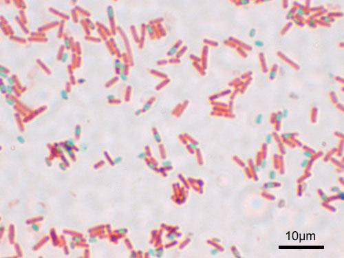 A stained preparation of the cell Bacillus subtilis showing endospores as green and the vegetative cell as red.